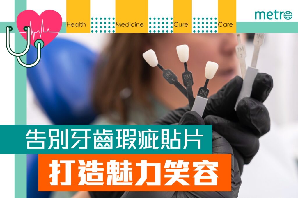 《metro》報導：告別牙齒瑕疵　貼片打造魅力笑容